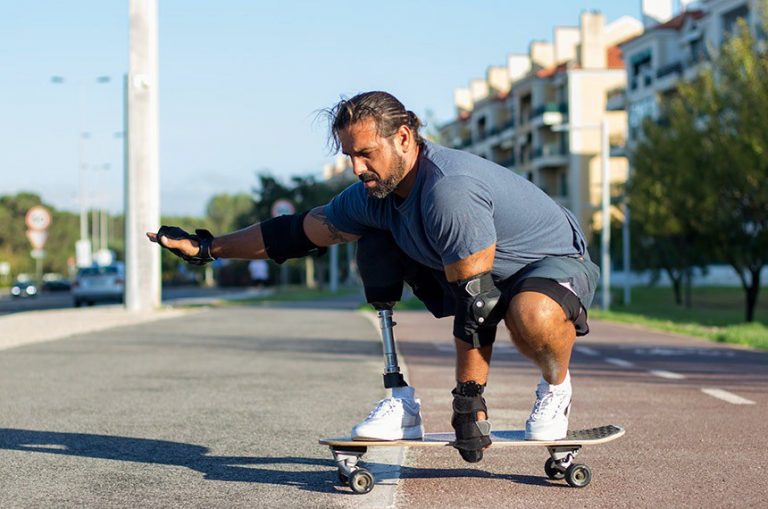 Nova lei cria data para destacar importância da inclusão de pessoas que não têm partes do corpo